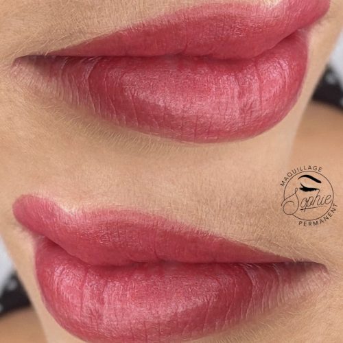 Full lips
