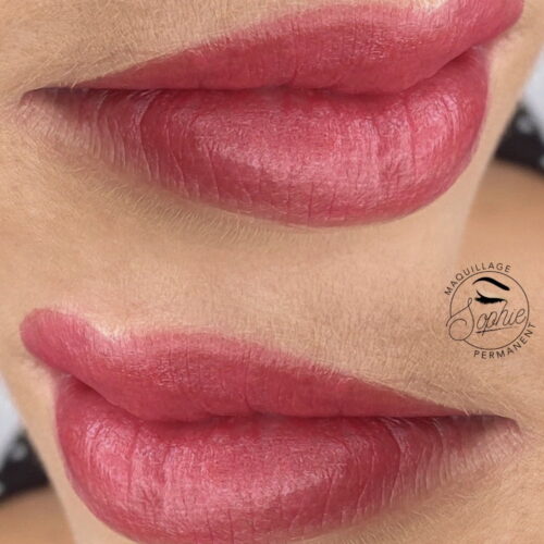 Full lips